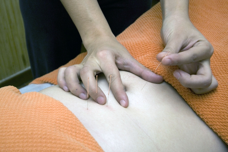 osteopathe-FLAYOSC-min_acupuncture-4175625